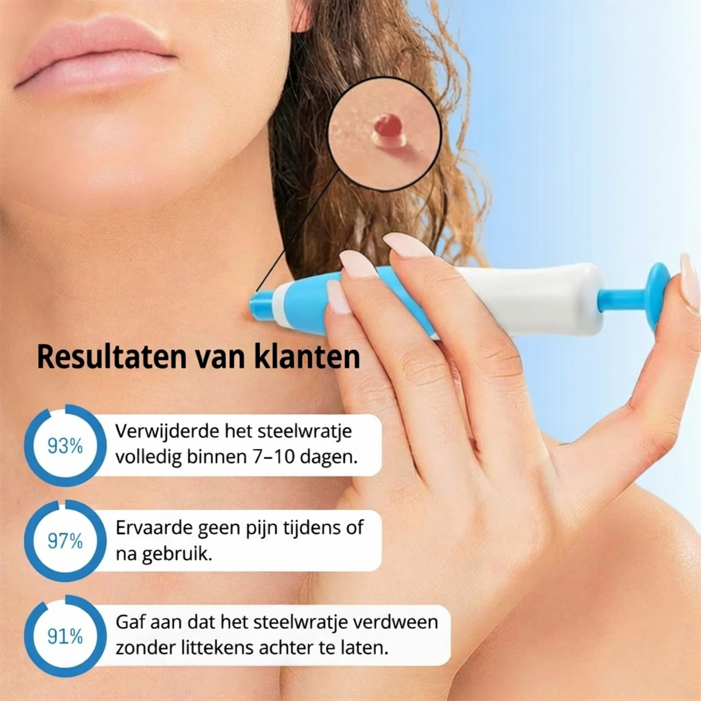 DermaClear – Pijnloze steelwratjes verwijderaar